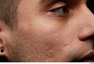 HD Face Skin Shawn Jacobs cheek eye face skin pores…